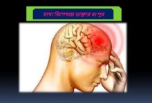 মাথা বিশেষজ্ঞ ডাক্তার রংপুর